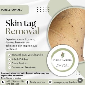 Skin tag removal